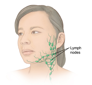 Three-quarter view of woman's head showing lymph nodes in neck.