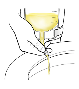 Closeup of hand holding tube on urinary catheter bag, draining urine into toilet.