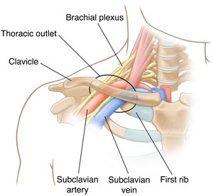 Front view of the neck and shoulder, showing the anatomy of the thoracic outlet.