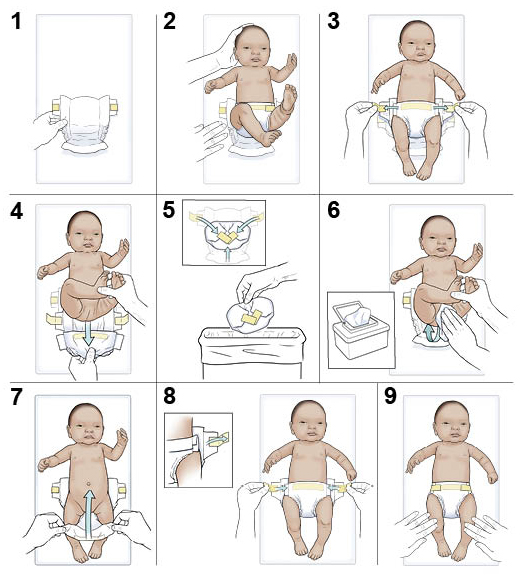 9 steps in changing a baby's diaper
