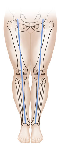Vista frontal de las piernas de un niño donde se observan los huesos alineados con normalidad.